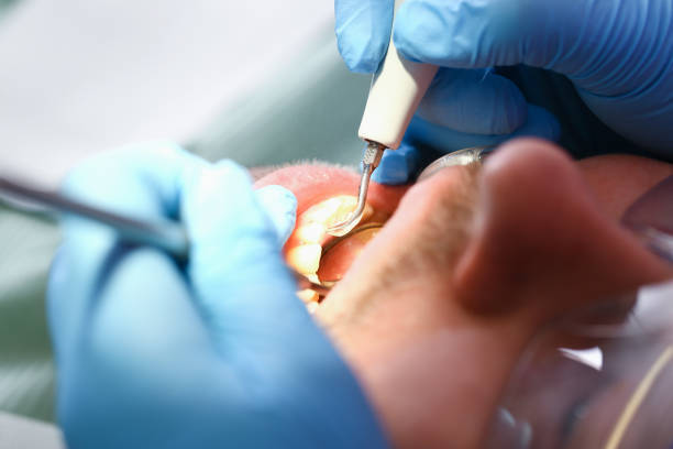Best Same-Day Emergency Dentist in Lake Forest Park, WA