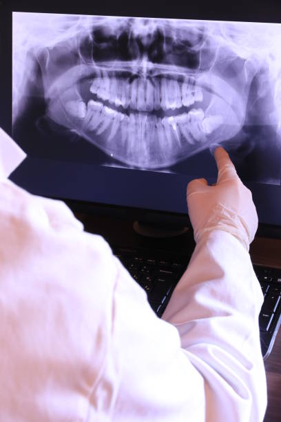 Best Emergency Root Canal Treatment in Lake Forest Park, WA