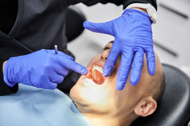 Best Emergency Broken Tooth Repair in Lake Forest Park, WA